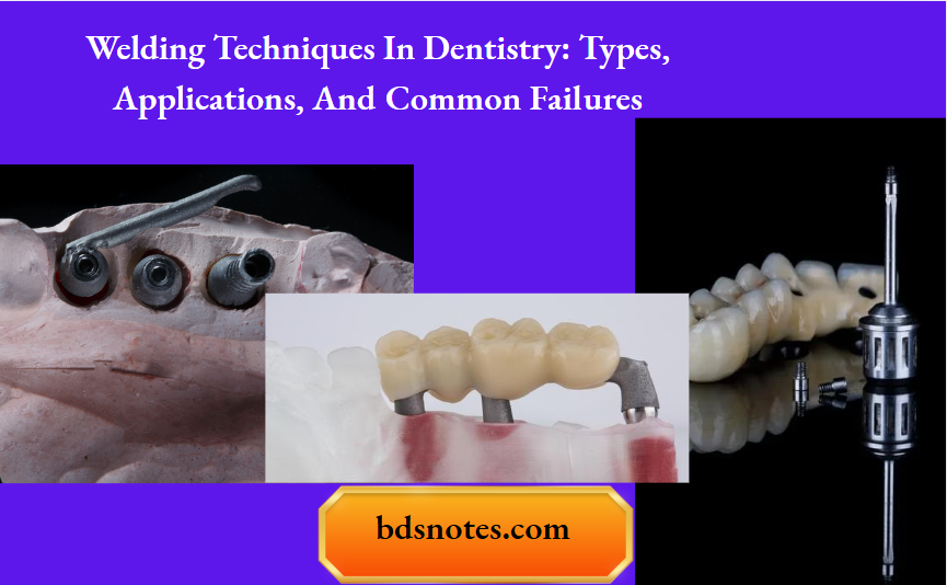 Welding Techniques In Dentistry Types Applications And Common Failures