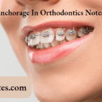 Anchorage In Orthodontics Notes