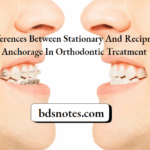 Anchorage Types Comparison Diagram