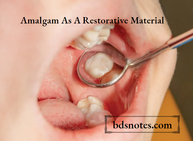 Dental AmalgamRestoration