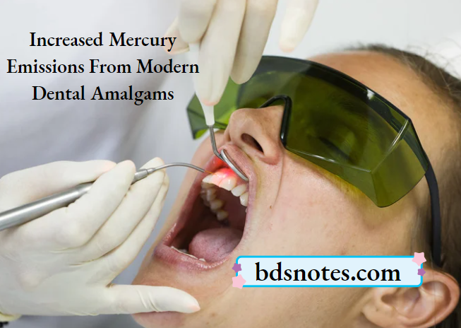 High Copper Amalgam Mercury Exposure