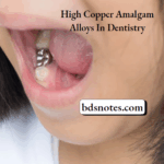 High Copper Amalgam Microstructure