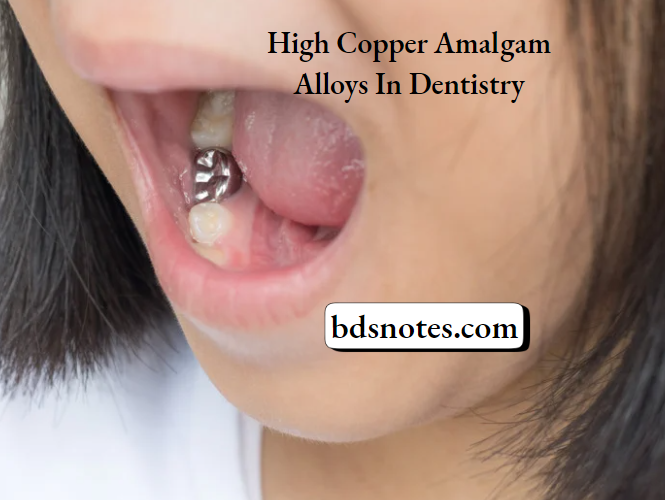 High Copper Amalgam Microstructure