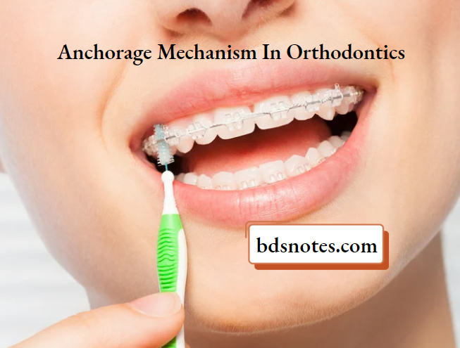 Orthodontic Anchorage Mechanism