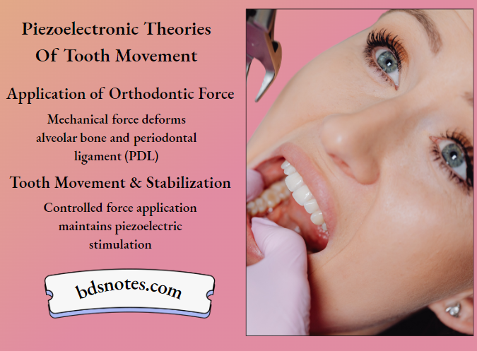 Piezoelectric Tooth Movement Mechanism