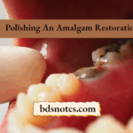 Post Carve Polish Amalgam Filling