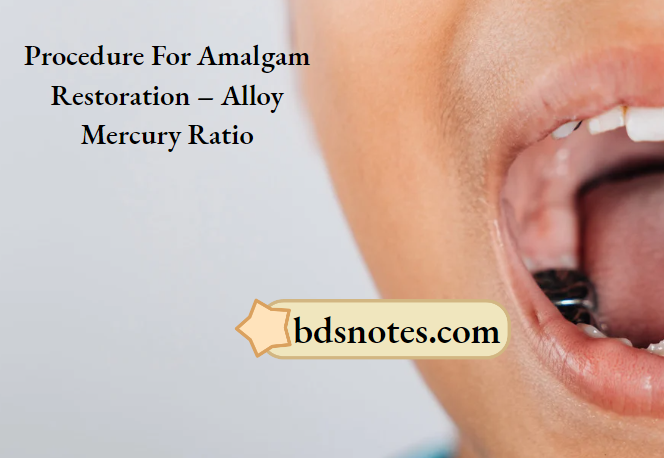 Proper Amalgam Mix _Alloy Hg Ratio