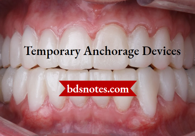 TAD Orthodontic Placement