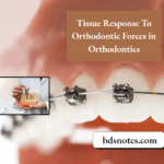 Tissue Response Orthodontic Forces