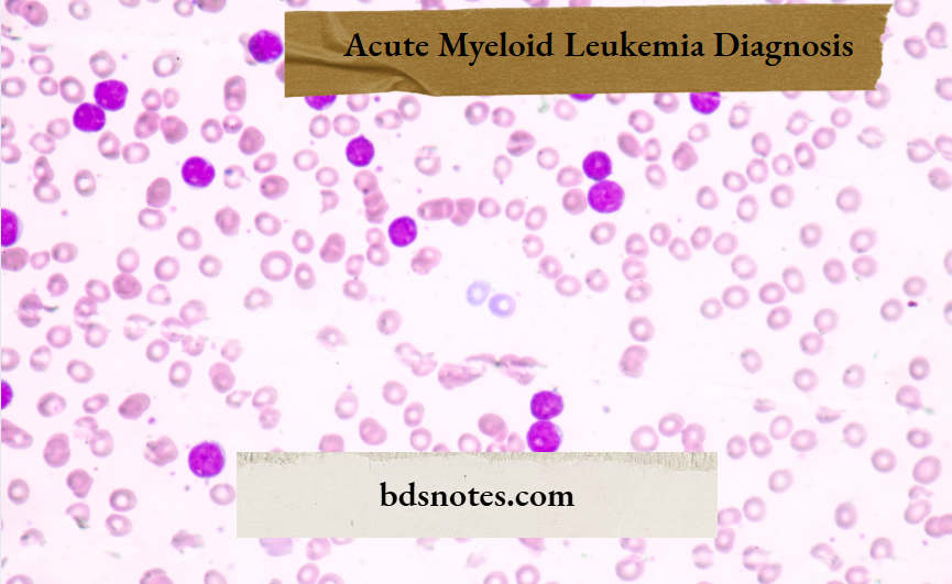 Acute Myeloid Leukemia Diagnosis