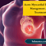 Acute Myocardial Infarction Management And Treatment