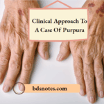 Clinical Approach To A Case Of Purpura