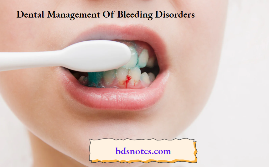 Dental Management Of Bleeding Disorders