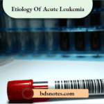 Etiology Of Acute Leukemia