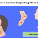 Evaluation Of Peripheral Lymphadenopathy In Adults