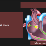 Heart Block