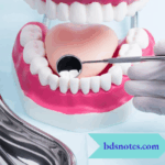 Indications For Treatment