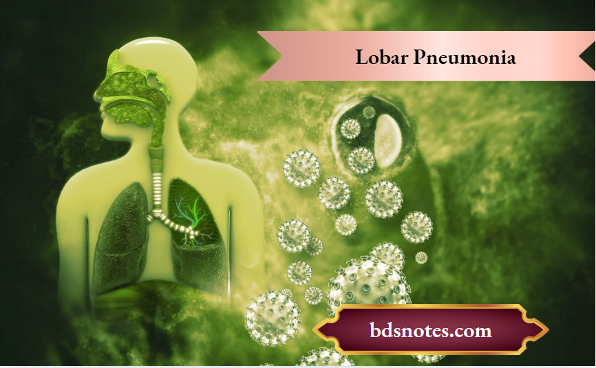 Lobar Pneumonia