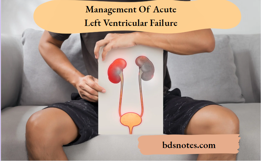 Management Of Acute Left Ventricular Failure