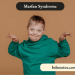 Marfan Syndrome