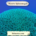 Massive Splenomegaly