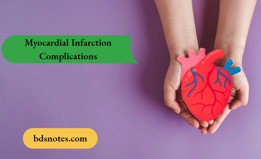 Myocardial Infarction Complications