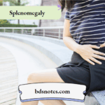 Splenomegaly