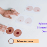 Splenomegaly - Hematology And Oncology