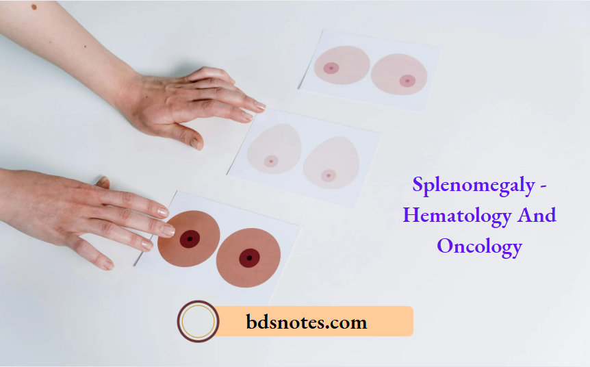 Splenomegaly - Hematology And Oncology