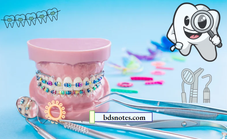 Understanding Anchorage In Orthodontics