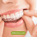 Understanding Extraoral Anchorage