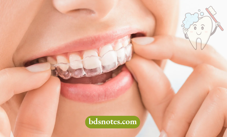 Understanding Extraoral Anchorage